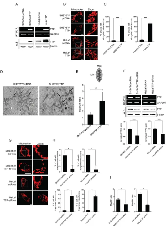 Figure 1: TTP overexpression induces mitochondrial elongation.  (A–E) SHSY5Y and/or HeLa cells were transiently transfected  with pcDNA6/V5-TTP (SHSY5Y/TTP and HeLa/TTP) or with empty vector pcDNA6/V5 (SHSY5Y/pcDNA and HeLa/pcDNA) for   48 h