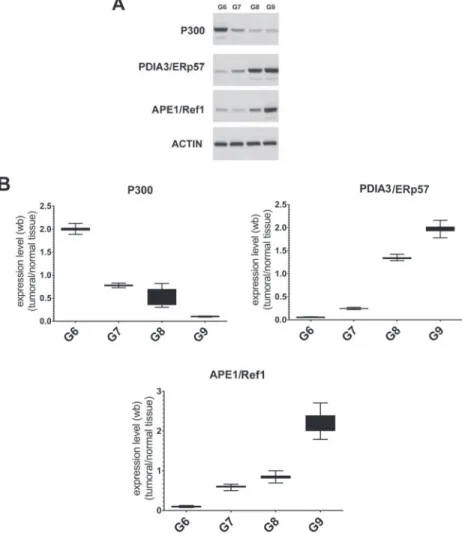 Figure 3: Analysis of STAT3 interactors in FFPE samples with different Gleason score.  (A) Representative Immunoblotting 