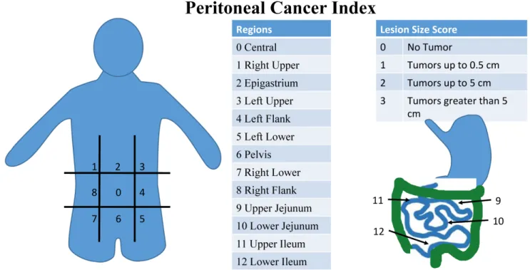 Figure 1: Peritoneal Cancer Index (PCI) scoring system.  PCI is a diagnostic and prognostic tool that is a sum of scores in thirteen  abdominal regions