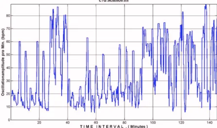 Figure 5 shows the fetal deceleration - pattern again  during the whole tracing (145, 2 min.)