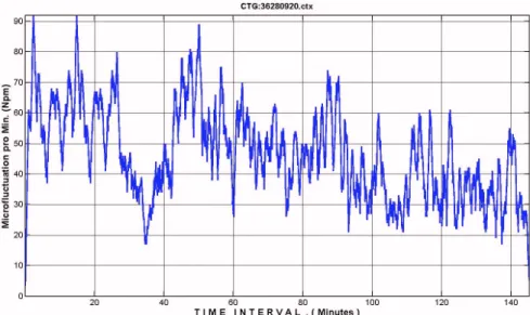 Figure  8 shows micro-fluctuation again during 25  min. covering the large deceleration of ca 9 min