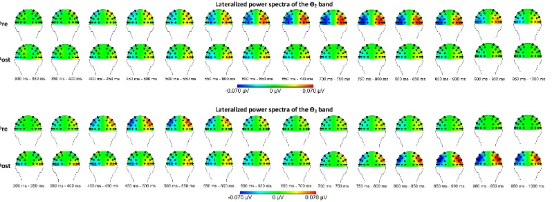Figure 2: Topographical maps of the between group results for the relevant θ-bands before and after the MBSR training