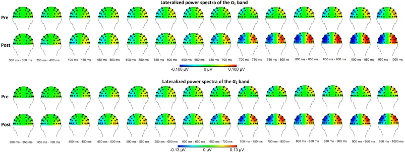 Figure 3. Topographical maps of the between group results for the α-bands before and after the MBSR training