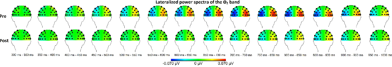 Figure 4: Topographical maps of the within group results for the relevant θ-band before and after the MBSR training