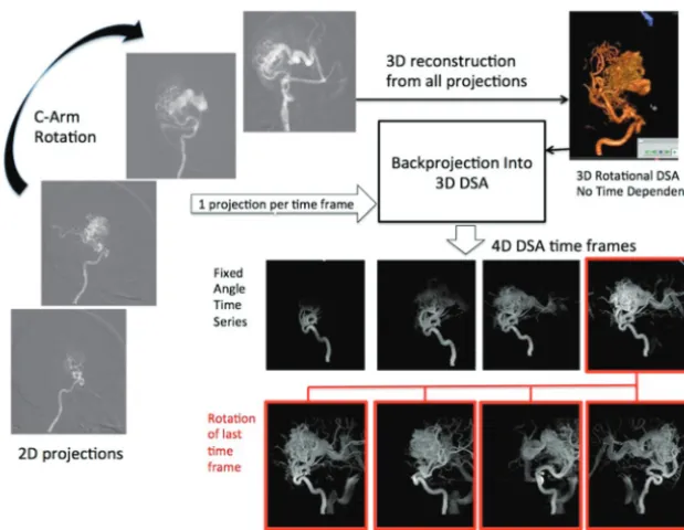 FIG 1. Schematic of 4D-DSA reconstruction. After creation of the 4D-DSA timeframes, each onemay be viewed in a dynamic form showing the inﬂow and outﬂow of contrast from the vascula-ture, just as with a standard 2D-DSA series