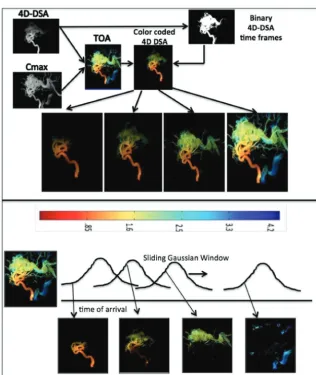 FIG 6. Color-coded 4D-DSA and bolus arrival images. The sequence was displayed at a rate of 6frames per second for visualization of arrival times between 1 and 4.5 seconds