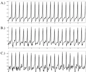 Figure 4. Autocorrelation function and partial autocorrelation  function of the seasonal SI t  without added noise