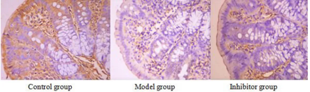 Table 2:  The expressions of AQP1, AQP3, AQP8 and NF-kB p65 in the colon by immunohisto- immunohisto-chemical technique