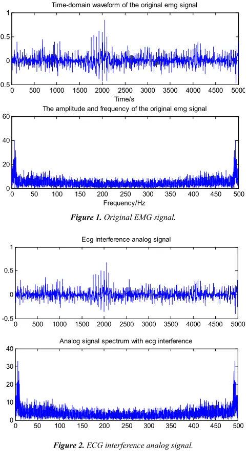 Figure 1. Original EMG signal. 