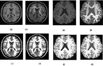 Fig. 1: Comparison of segmentationresults on simulated T1 MR image