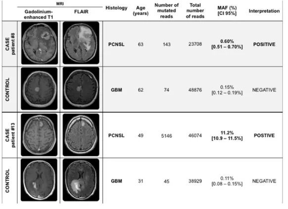 Figure 4: Two representative case-control examples of the detection of MYD88 c.T778C in plasma samples by NGS.