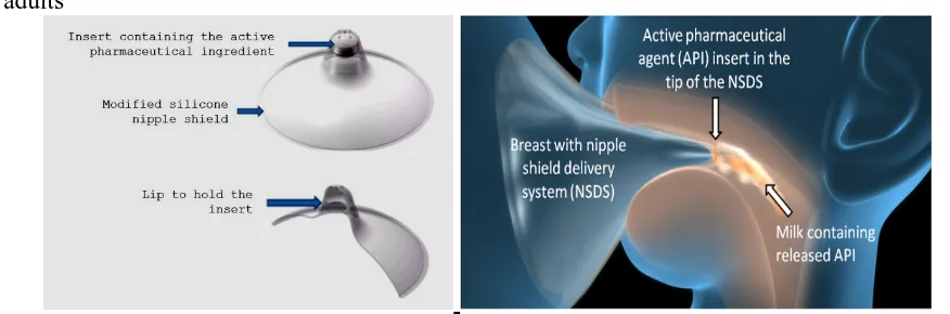 Figure 14: Nipple Shield Delivery System (NSDS)  