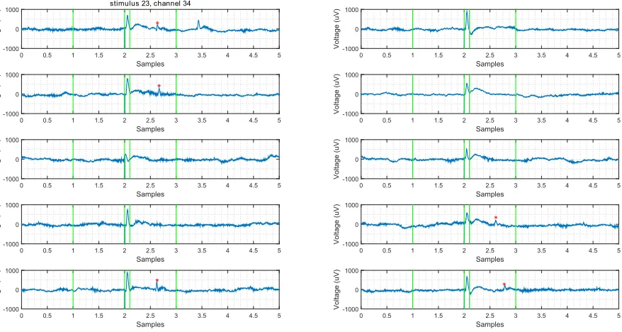 Figure 4.2: This is an example of how the DRs were visually annotated. The small grid helps in deciding whether a waveis too slow or not