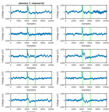 Figure 4.7: Examples of false negative and false positive DR in Patient 29.