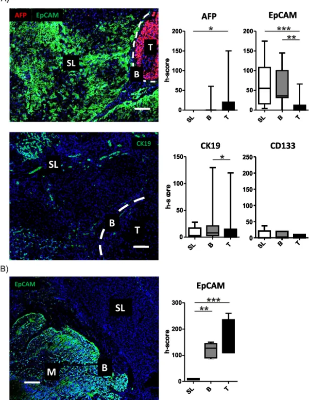 Figure 3: Activation of stemness markers in peritumoral tissues.  A. Activation of stemness marker in the different regions  was determined by confocal imaging