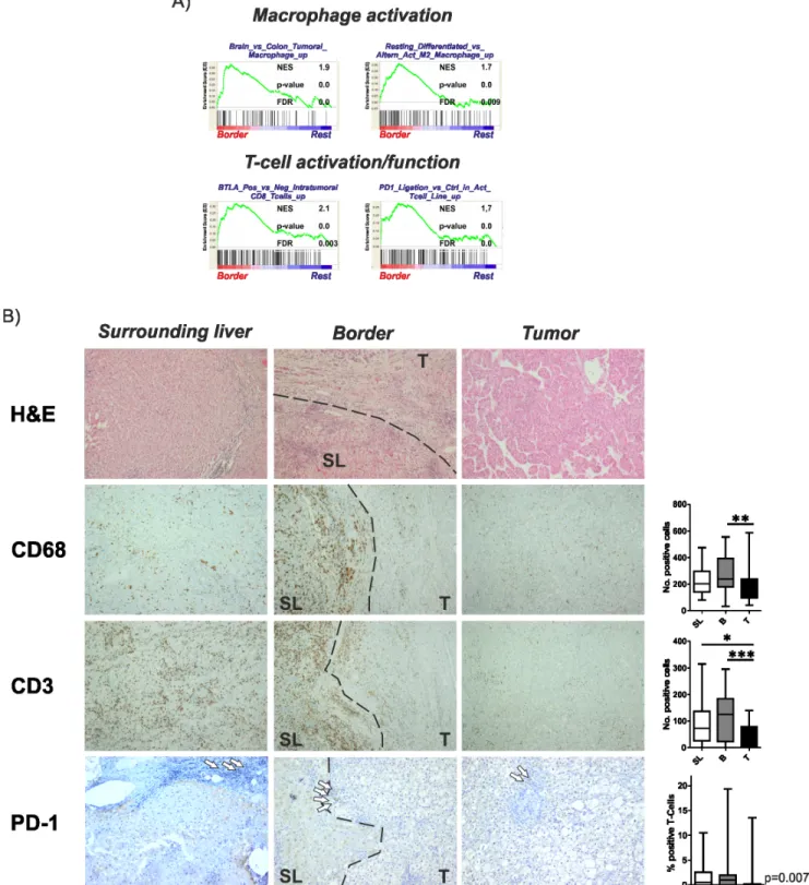Figure 4: Activation of inflammatory gene sets and immune cells in the invasive tumor margin