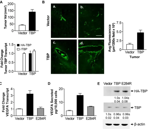 Figure 2: Rat1a cells with enhanced TBP expression form tumors with increased von Willebrand staining and exhibit  increased VEGFA expression