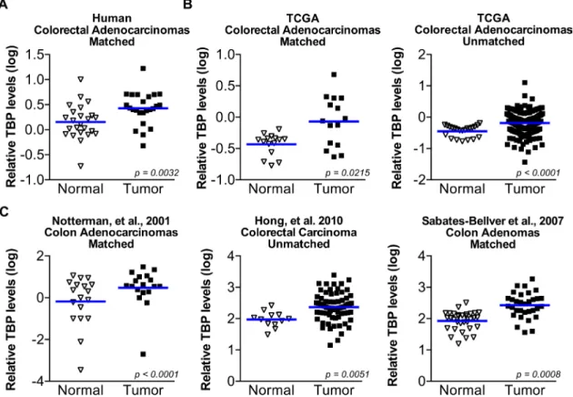 Figure 7: TBP is increased in a statistically significant number of human colorectal tumors compared to normal tissue