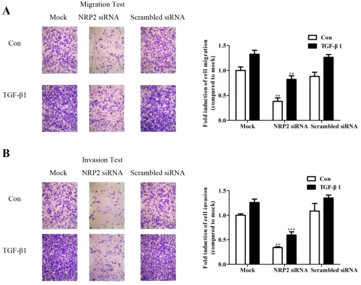 Figure 5: NRP2 promotes TGF-β1-mediated migration and invasion.  MDA-MB-231 cells were transfected with 80 nm NRP2  siRNA and siRNA negative controls, the migratory (A) and invasive (B) behaviors were measured at 24 h after stimulation with 5 ng/ml  TGF-β1