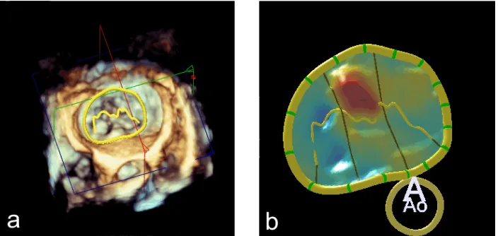 Figure 2.1: The results of the Mitral Valve Navigator (Netherlandscation for the user