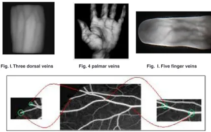 Fig. I. Three dorsal veins   