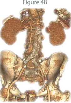 Figure 4AFigure 4B