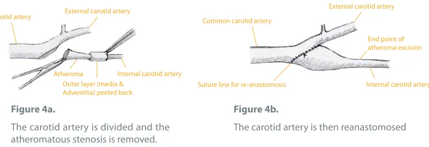Figure 4a.Figure 4b.