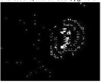 Figure 5. OUTPUT IMAGE WITH EXUDATES DETECTED 