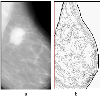 Fig. 3: (a) The prepared Mammogram and (b) 