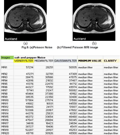 Fig.8: (a)Poisson Noise      (b) Filtered Poisson MRI image