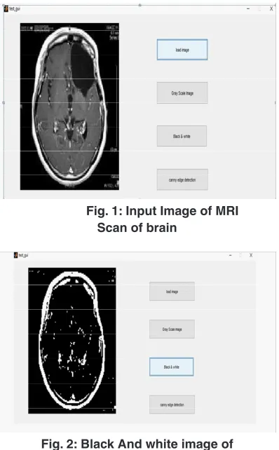 Fig. 1: Input Image of MRI 