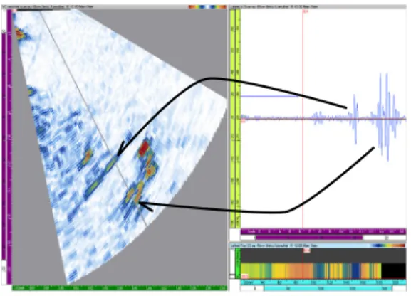 Fig. 1. Amplitude versus time signals (A-scan) shown on the right are collected at a range of angles and displayed in a typical sector scan image.