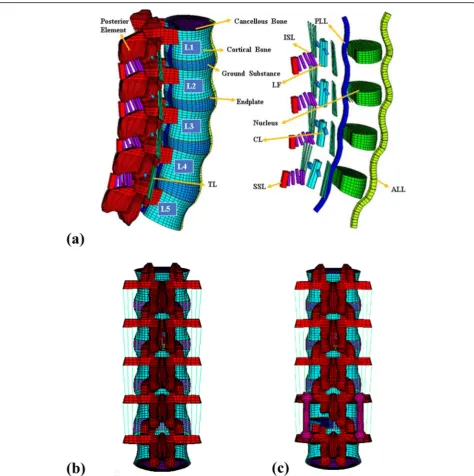 Fig. 1 FE models of the spine with a spinal fixator and with the fixator removed; a) Bones, intervertebral discs, and ligaments of the intact spine.b) Mesh of intact FE models used in this study