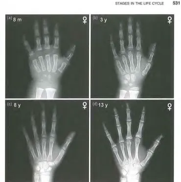 Figure 11.6 Radiographs of the hand and wrist at different skeletal ages, illustrating the with kind permission from Springer 8 years old, all ossification centers are calcified