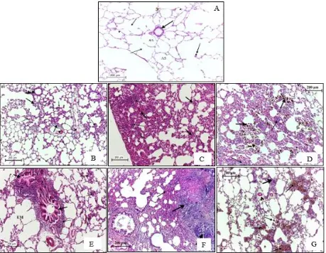 Fig. 1. Histological section of lung from (A) the control group and (B, C, D, F, G) treated group with (0.5, 1.5, 0.5, 5, 15, 50, 150) mg/kg of TiO2 NP respectively, after 4 days from intratracheal instillation, (A) showing the normal structure of alveoli (thin arrow), terminal bronchiole (thick arrow) and normal alveolar lining epithelial (heads 