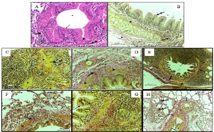 Fig. 2. Section of lung from the control group (A, B) and treated group (C, D, F, G, H) with (0.5, 1.5, 0.5, 5, 15, 50,  150) mg/kg of TiO2 NP respectively, after 4 days post-instillation, (A, B) showing the normal bronchus lining epithelial (thin arrow), 