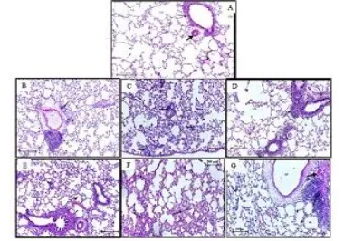 Fig. 5. Histopathological alteration on lung section of the treated groups (B, C, D, E, F, G) with (0.5, 1.5, 0.5, 5, 15,  50, 150) mg/kg of TiO2 NP respectively comparing with control group (A) after 3 months post-instillation, the section revealed cluste