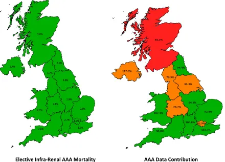 Figure 7.7 - Map of UK showing elective infra-renal AAA mortality by region alongside regional data contribution rates for England and the Celtic Nations 01/10/08-30/09/10