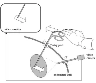 Figure 1: The fulcrum effect 