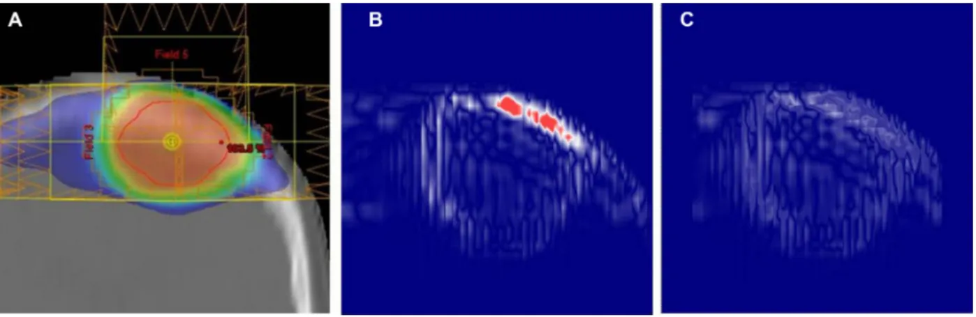 Figure 2:  Center-coronal dose analysis results for the worst pixel-dose agreement case: (A) dose distribution in the original plan, (B) 