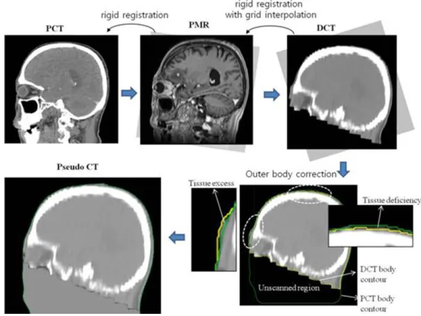 Figure 4: Work flow for pseudo-CT generation method used in the study. 