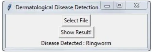 Figure 5.6 Image of Ringworm imported to the user interface 