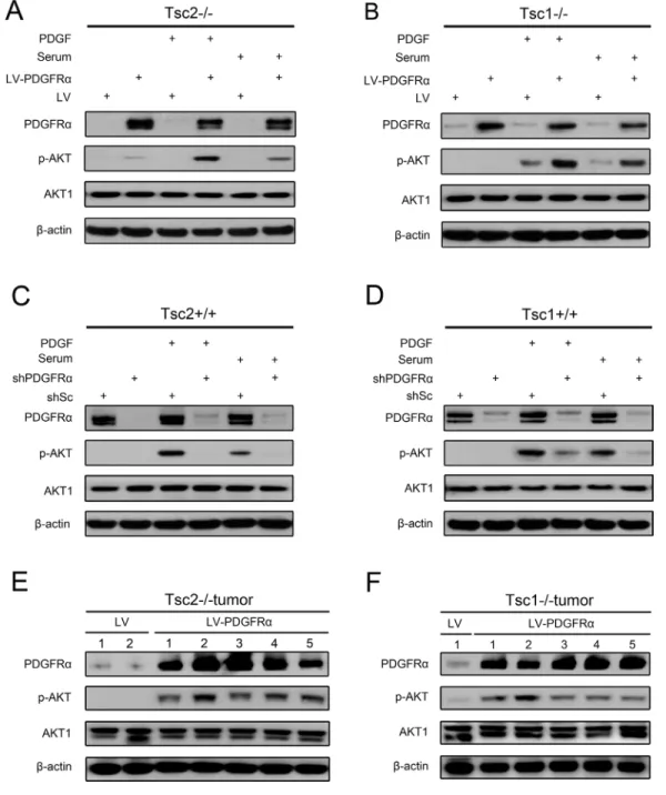 Figure 3: PDGFRα is essential for AKT activation.  (A, B) Tsc2−/− (A) or Tsc1−/− MEFs (B) were transduced with LV-PDGFRɑ or  LV lentiviruses