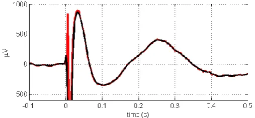 Figure 2 Results of the initial artefact removal. The original signals (multi-colored) and its average (black) are shown in the top graph
