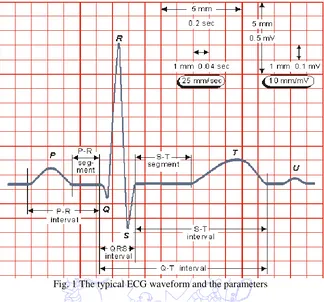 Fig. 1 The typical ECG waveform and the parameters 