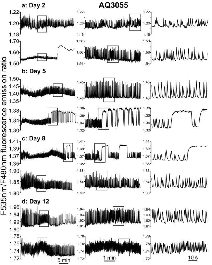 Figure 2: Representative traces of [Ca 2+ ]