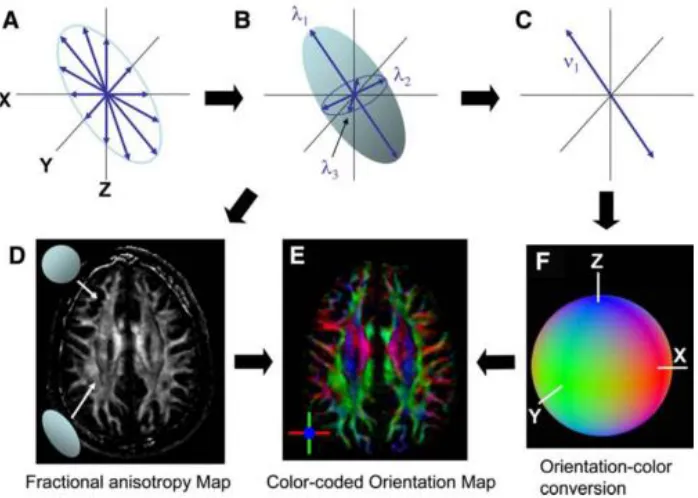 Figure 2.6. With tractography, fiber systems are reconstructed based on the eigenvector fields in the DTI 