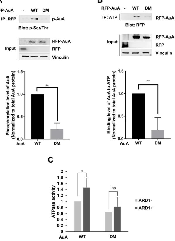 Figure 4: ARD1-mediated AuA acetylation at K75/K125 enhances AuA kinase activity.  ( A) Phosphorylation level of AuA is  decreased in cells overexpressing K75R/K125R mutant