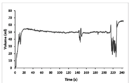 Fig. 4 Changes in venous volume during different maneuvers  measured by the stretch sensors on a normal subject 