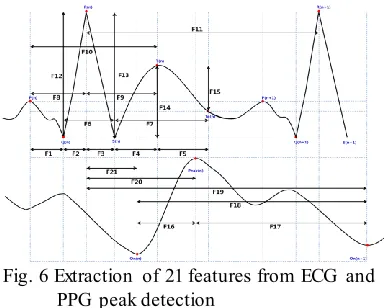 Fig. 5 Results from the detection of PPG Peaks 